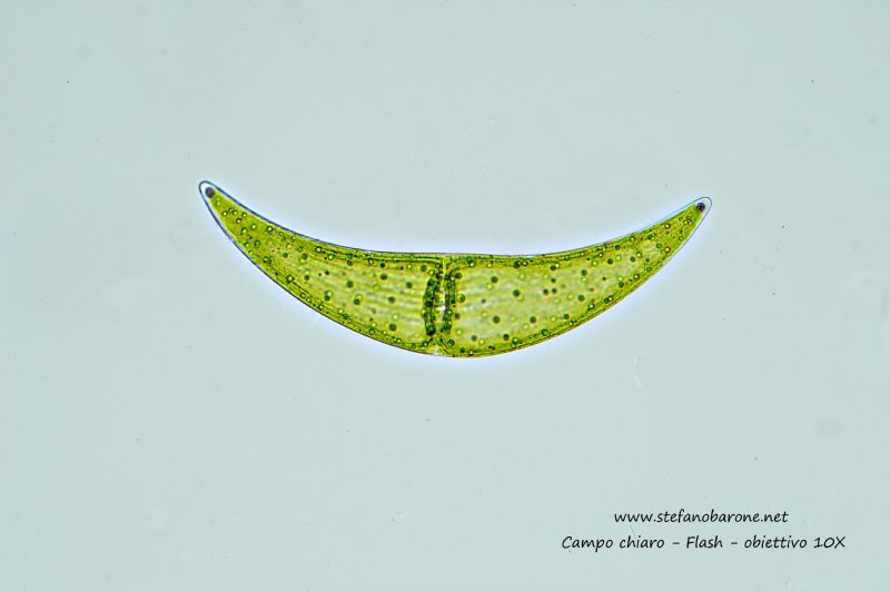 Closterium sp.: L''alga a mezzaluna che 